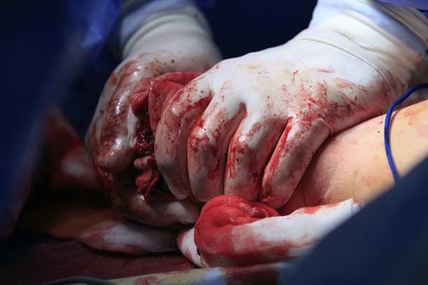 trauma%20anaesthetic%20nursing.jpg