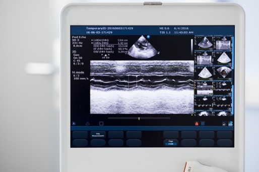 ultrasound.jpg