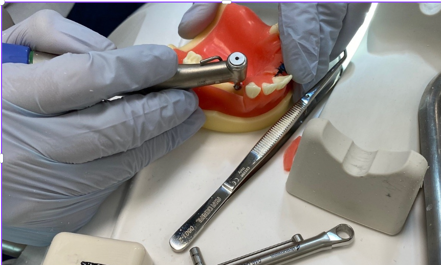 Advanced Digital Implant Reconstruction: From Single Tooth to Full Arch
