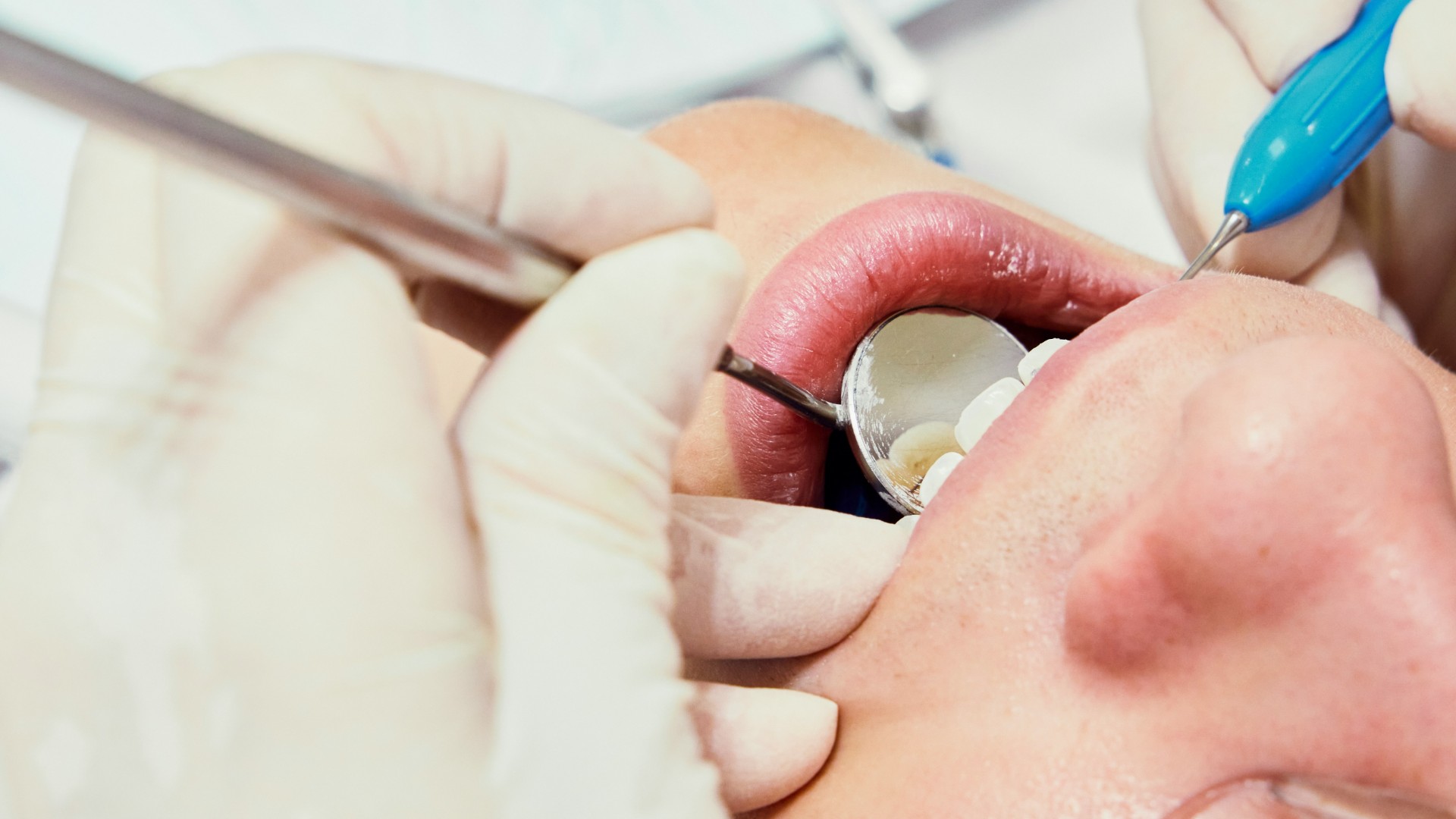 Practical Oral Surgery - February