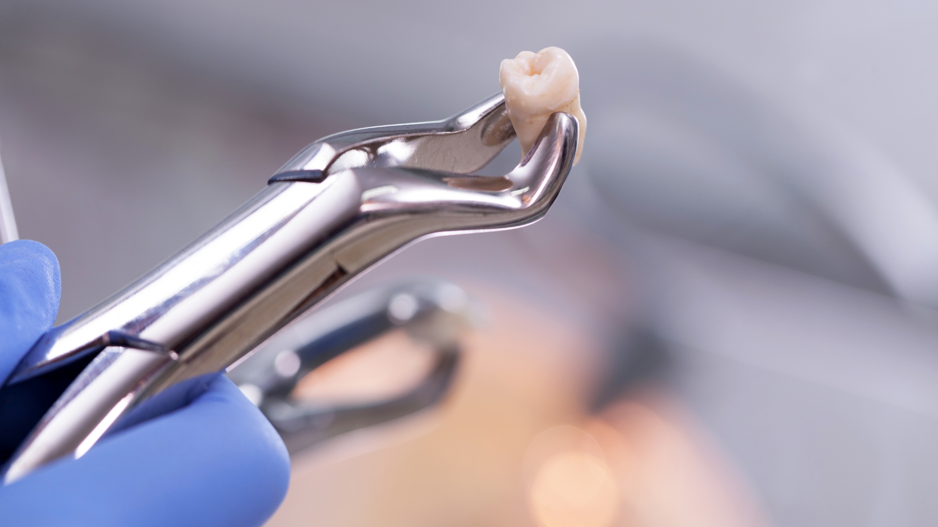 No Roots Left Behind: Hands-on surgical extraction techniques