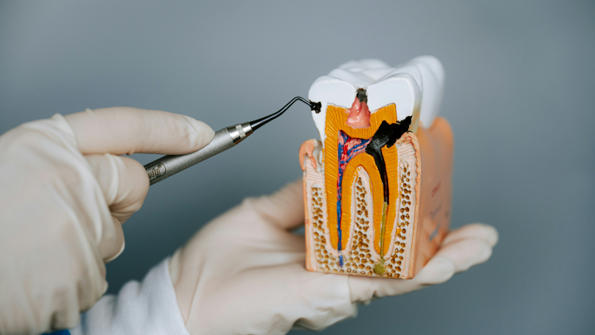 No Roots Left Behind: Hands-on surgical extraction techniques