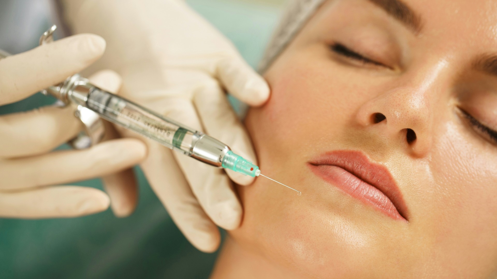  The Therapeutic Uses of Botulinum Toxin and Intraoral Dermal Fillers in General Dental Practice